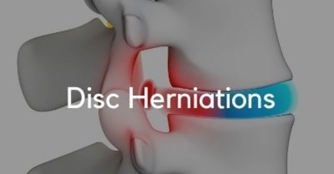  Disc Herniations